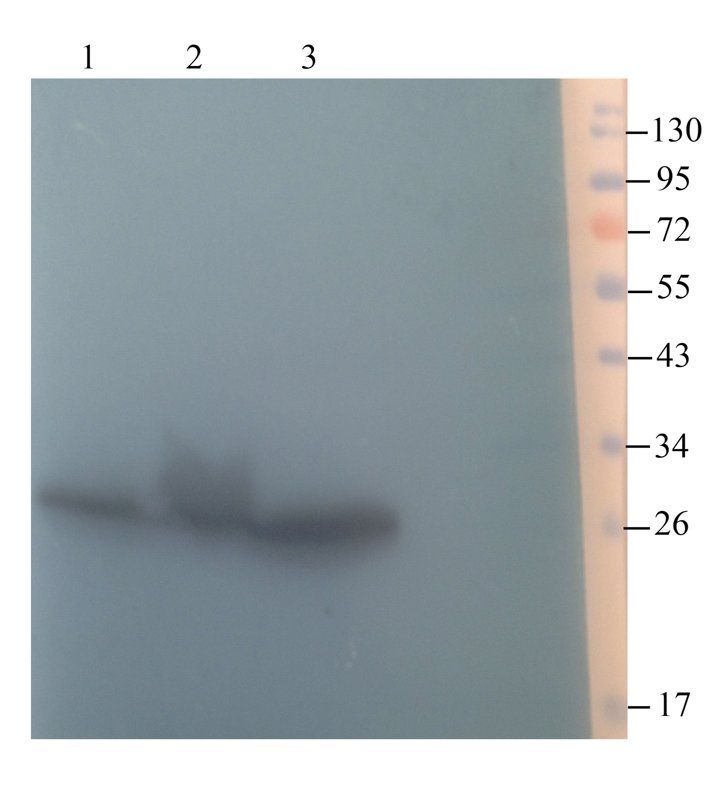 SOD2 antibody