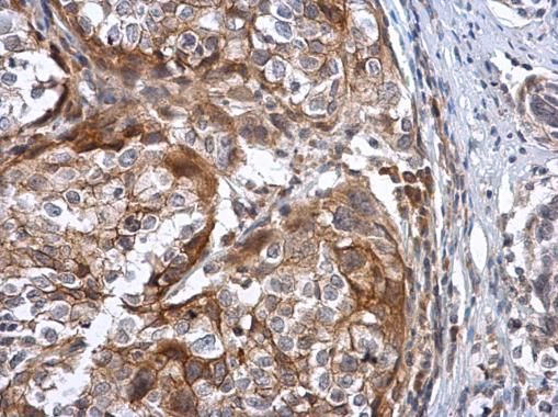 Sodium/Potassium ATPase beta 3 antibody [N2C3]