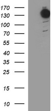 Solo Antibody