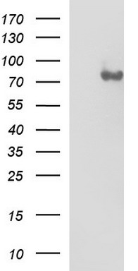 Solo Antibody