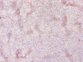 SLC41A2 Antibody