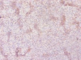 Solute carrier family 41 member 2 antibody