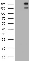 Somatostatin Receptor 2 (SSTR2) antibody