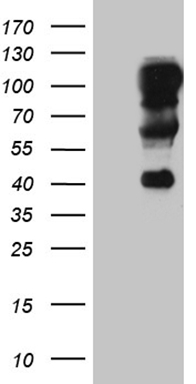 Somatostatin Receptor 3 (SSTR3) antibody