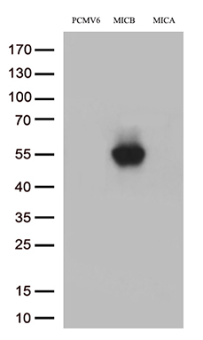Somatostatin Receptor 5 (SSTR5) antibody