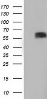 Sorbitol Dehydrogenase (SORD) antibody