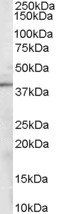 Goat anti-Sorbitol Dehydrogenase Antibody
