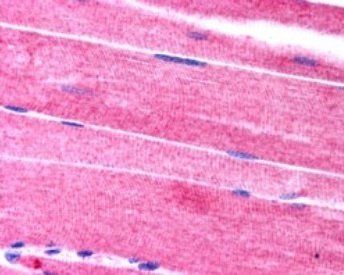 Goat anti-SORBS1 / Ponsin (C Terminus) Antibody