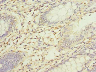 SORBS3 Antibody