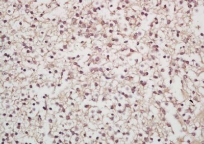 SORCS1 antibody