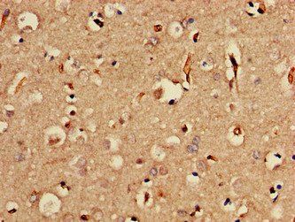 SORCS2 Antibody