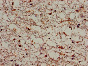 SORL1 Antibody