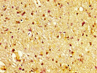 SORT1 Antibody