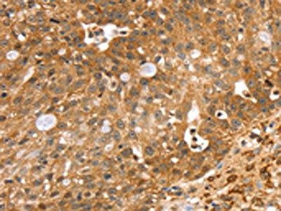 SORT1 Antibody