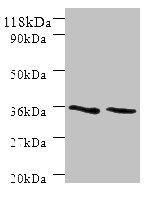 Sorting nexin-20 antibody