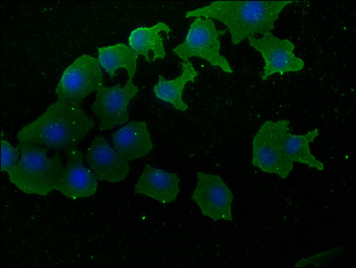 SOS2 antibody