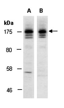 SOS2 (M) Antibody, Rabbit Polyclonal