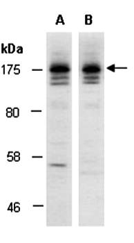 SOS2 (C) Antibody, Rabbit Polyclonal