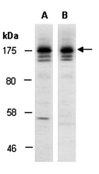 SOS2 (vPairTM) Antibodies