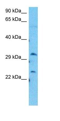 SOSB1 antibody