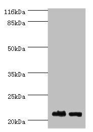 SOSS complex subunit B2 antibody