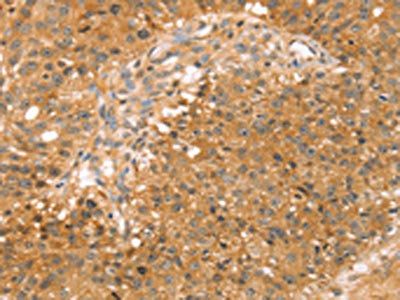 SOX11 Antibody