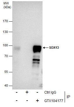 SOX13 Rabbit Polyclonal Antibody
