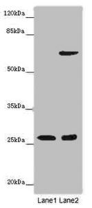 SOX14 antibody