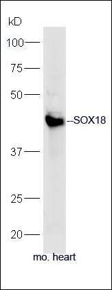 SOX18 antibody