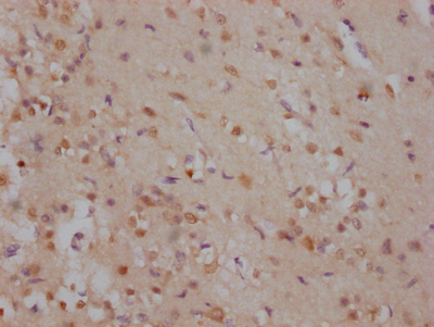 SOX2 Recombinant Monoclonal Antibody