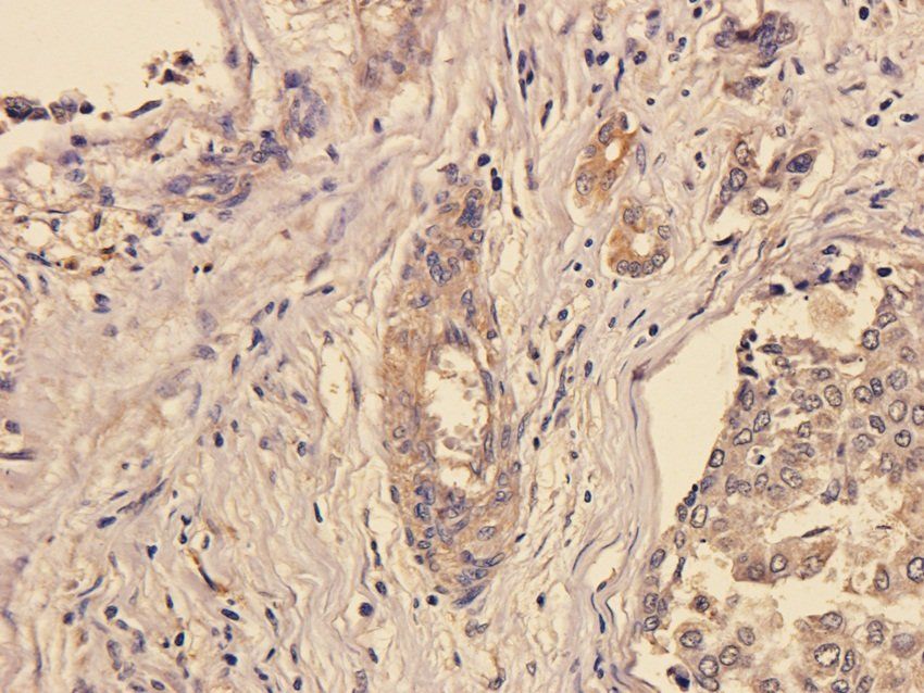 SOX2 antibody
