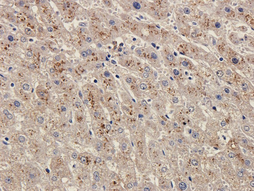 SOX2 antibody