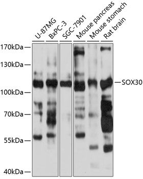 SOX30 antibody