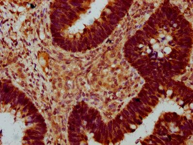 SOX30 Antibody