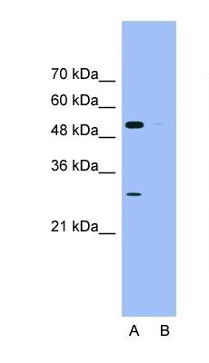 SOX5 antibody