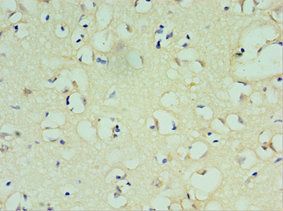 SOX6 Antibody
