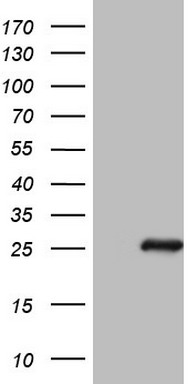 SP17 (SPA17) antibody