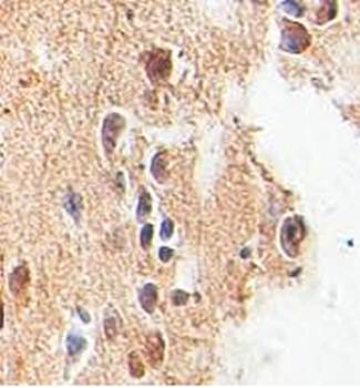 Sp4 Rabbit Polyclonal Antibody