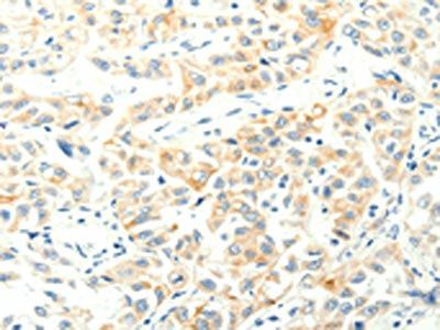 SPAG5 Antibody