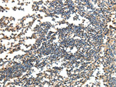 SPAG8 Antibody
