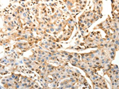 SPAG8 Antibody