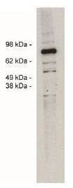 SPARC antibody