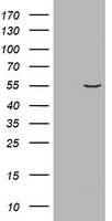 SPARC antibody