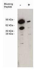 SPARC antibody