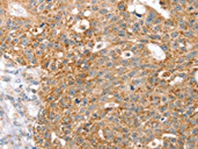 SPARCL1 antibody