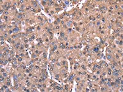 SPAST Antibody