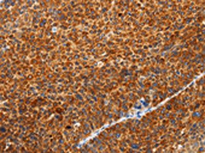 SPATA13 Antibody