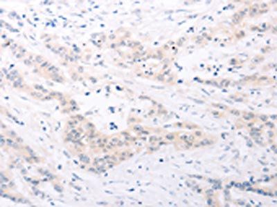SPATA16 Antibody