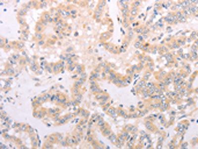 SPATA16 Antibody