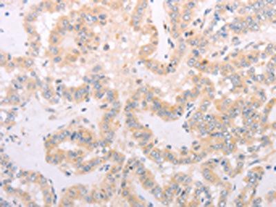 SPATA16 antibody